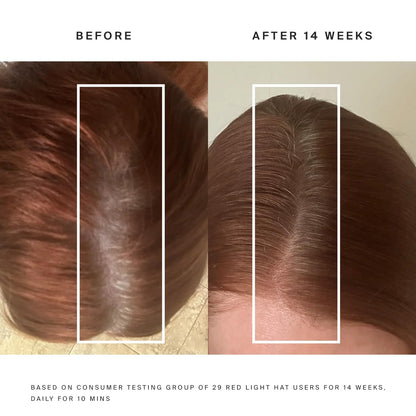 Jobimessentials Hair regrowth light therapy cap