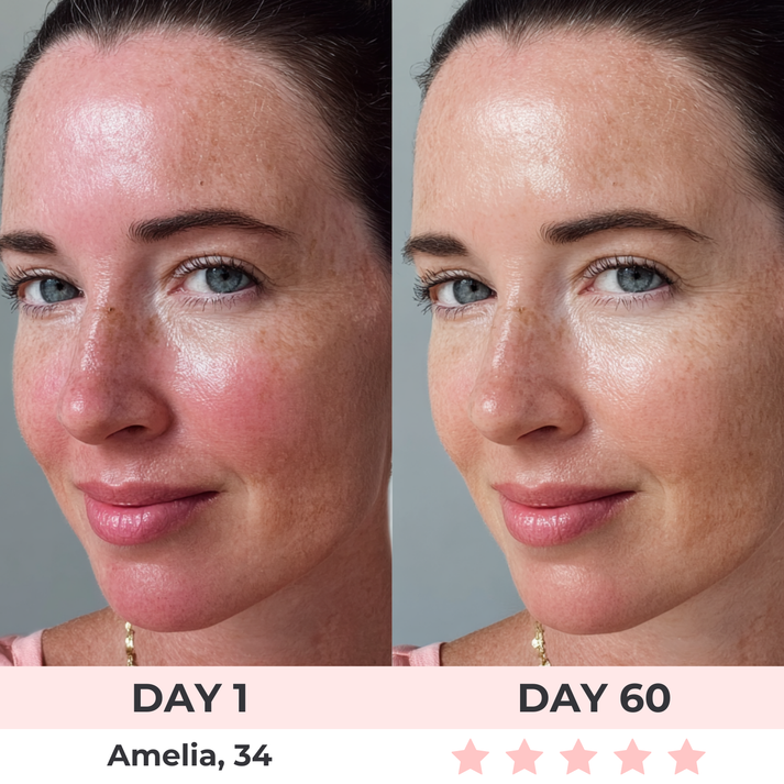 Jobimessentials- LED Face Mask for Anti-Aging & Acne